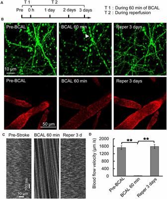 Pharmacological Targeting of CSF1R Inhibits Microglial Proliferation and Aggravates the Progression of Cerebral Ischemic Pathology